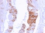 Cytokeratin 20 (KRT20) Antibody in Immunohistochemistry (Paraffin) (IHC (P))