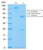 Cytokeratin 20 (KRT20) Antibody in SDS-PAGE (SDS-PAGE)