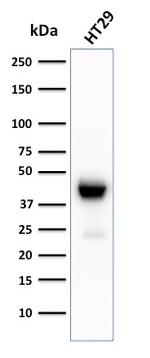 Cytokeratin 20 (KRT20) Antibody in Western Blot (WB)