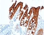 Cytokeratin 20 (KRT20) (Colorectal Epithelial Marker) Antibody in Immunohistochemistry (Paraffin) (IHC (P))