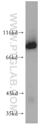 NBS1 Antibody in Western Blot (WB)