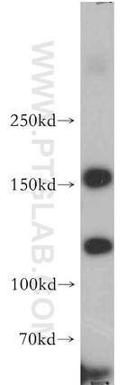 SOS1 Antibody in Western Blot (WB)