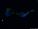 PPP3CB Antibody in Immunocytochemistry (ICC/IF)