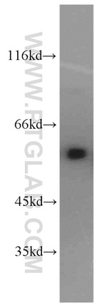 PPP3CB Antibody in Western Blot (WB)