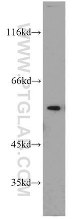 PPP3CB Antibody in Western Blot (WB)