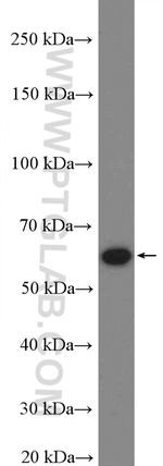 PPP3CB Antibody in Western Blot (WB)