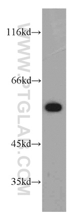 PPP3CB Antibody in Western Blot (WB)