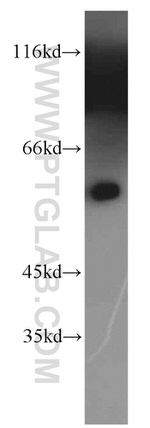 PPP3CB Antibody in Western Blot (WB)