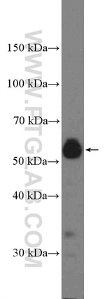 PPP3CB Antibody in Western Blot (WB)