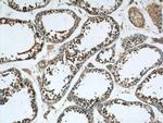 CPSF7 Antibody in Immunohistochemistry (Paraffin) (IHC (P))