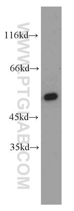 CPSF7 Antibody in Western Blot (WB)