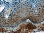 CPSF7 Antibody in Immunohistochemistry (Paraffin) (IHC (P))