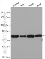 CPSF7 Antibody in Western Blot (WB)