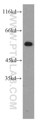 CPSF7 Antibody in Western Blot (WB)