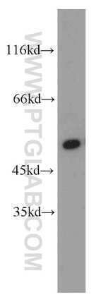 CPSF7 Antibody in Western Blot (WB)