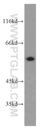 CPSF7 Antibody in Western Blot (WB)