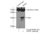 TPSD1 Antibody in Immunoprecipitation (IP)