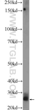 TPSD1 Antibody in Western Blot (WB)