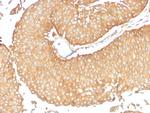 Calcineurin A/PPP3CA Antibody in Immunohistochemistry (Paraffin) (IHC (P))