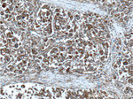 ATP6 Antibody in Immunohistochemistry (Paraffin) (IHC (P))