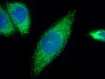 ATP6 Antibody in Immunocytochemistry (ICC/IF)