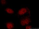 SETD2 Antibody in Immunocytochemistry (ICC/IF)