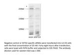 SETD2 Antibody in Western Blot (WB)
