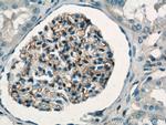 HLA-A Antibody in Immunohistochemistry (Paraffin) (IHC (P))