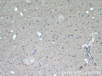 VGLUT1 Antibody in Immunohistochemistry (Paraffin) (IHC (P))