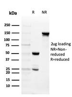 Intelectin 1/Omentin Antibody in SDS-PAGE (SDS-PAGE)