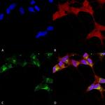 Beta 3 GABA-A Receptor Antibody in Immunocytochemistry (ICC/IF)