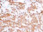 S100A14 (S100 calcium binding protein A14) Antibody in Immunohistochemistry (Paraffin) (IHC (P))