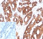 S100A14 (S100 calcium binding protein A14) Antibody in Immunohistochemistry (Paraffin) (IHC (P))