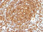 CD45RB (B-Cell Marker) Antibody in Immunohistochemistry (Paraffin) (IHC (P))