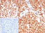 CD45/LCA (B-Cell Marker) Antibody in Immunohistochemistry (Paraffin) (IHC (P))