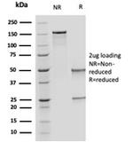 OVOL2/CRE-BPa Antibody in SDS-PAGE (SDS-PAGE)