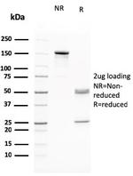 RAD51 (Prognostic and Response to Chemotherapy Marker) Antibody in SDS-PAGE (SDS-PAGE)
