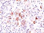 Bcl-X (Apoptosis Marker) Antibody in Immunohistochemistry (Paraffin) (IHC (P))