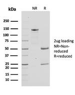 Bcl-X (Apoptosis Marker) Antibody in SDS-PAGE (SDS-PAGE)