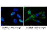 Telomerase catalytic subunit Antibody in Immunocytochemistry (ICC/IF)