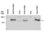 Telomerase catalytic subunit Antibody in Western Blot (WB)