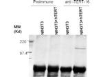 Telomerase catalytic subunit Antibody in Western Blot (WB)
