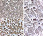 PPAR Delta Antibody in Immunohistochemistry (IHC)