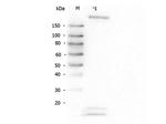 ROBO-1 Antibody in Western Blot (WB)