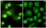 Thyroid Hormone Receptor beta 1 Antibody in Immunocytochemistry (ICC/IF)