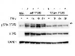 Phospho-STAT2 (Ser734) Antibody in Western Blot (WB)