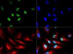 H3R2me2sT3ph Antibody in Immunocytochemistry (ICC/IF)