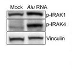 Phospho-IRAK4 (Thr345) Antibody in Western Blot (WB)