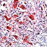 Osteopontin (SPP1) Antibody in Immunohistochemistry (Paraffin) (IHC (P))