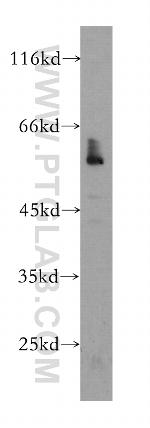 NR1H3 Antibody in Western Blot (WB)